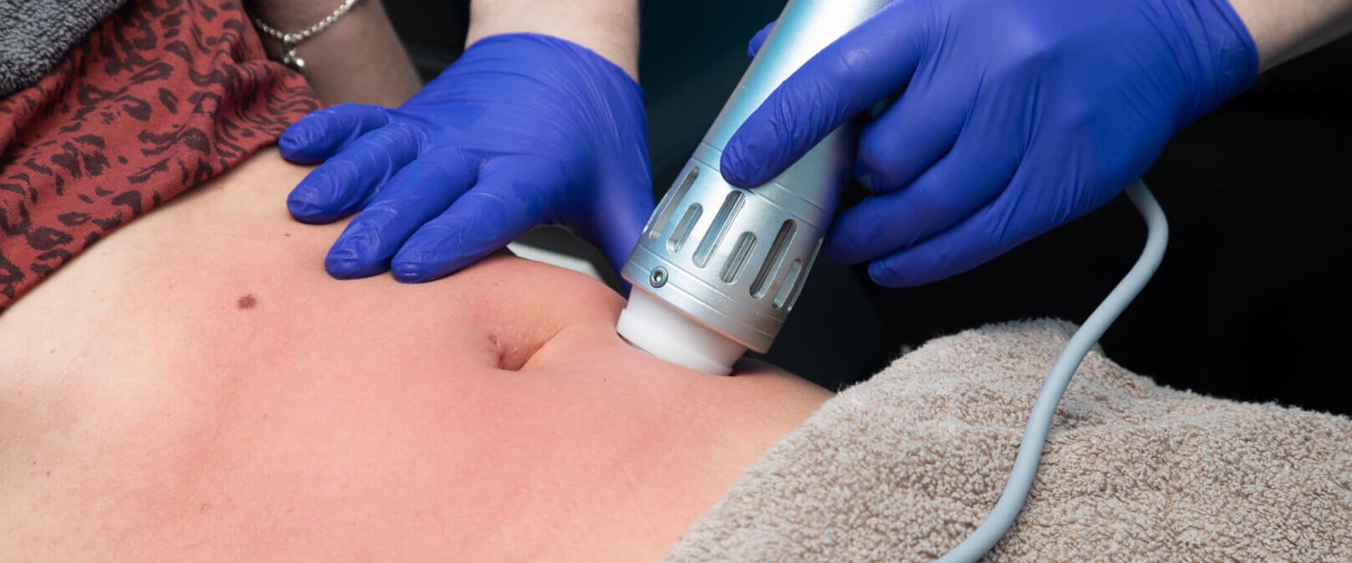 What can i expect after shock wave therapy?
