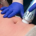 How long after shockwave therapy can i exercise?